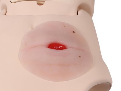 Wound moulage colostomy in abdominal fold, self-adhesive - Erler-Zimmer PW023P, view 3