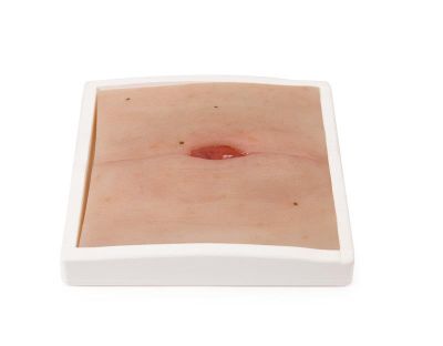 Wound Moulage Colostomy in abdominal crease, incl. stand - Erler-Zimmer PW023, view 2