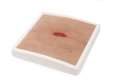 Wound Moulage Colostomy in abdominal crease, incl. stand - Erler-Zimmer PW023