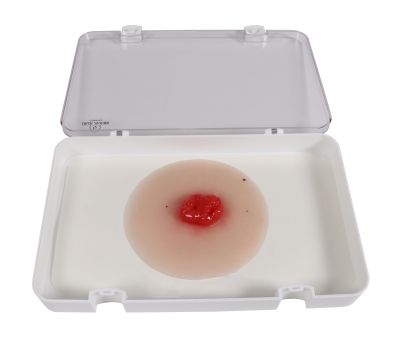 Wound moulage colostomy double-barrel, self-adhesive - Erler-Zimmer PW025P