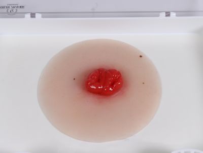 Wound moulage colostomy double-barrel, self-adhesive - Erler-Zimmer PW025P, view 2