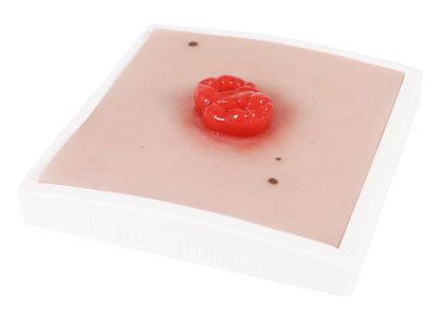 Wound moulage colostomy double-running, incl. stand - Erler-Zimmer PW025, view 2