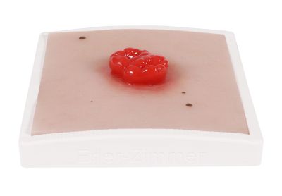Wound moulage colostomy double-running, incl. stand - Erler-Zimmer PW025, view 4