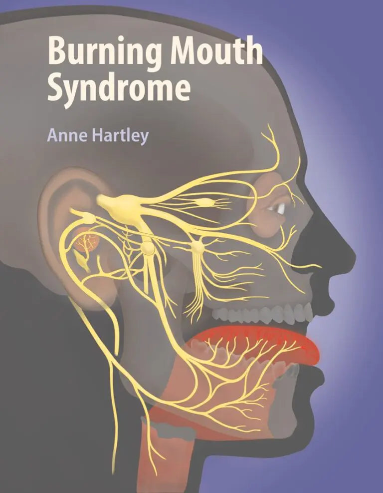 Burning Mouth Syndrome Book by Anne Hartley