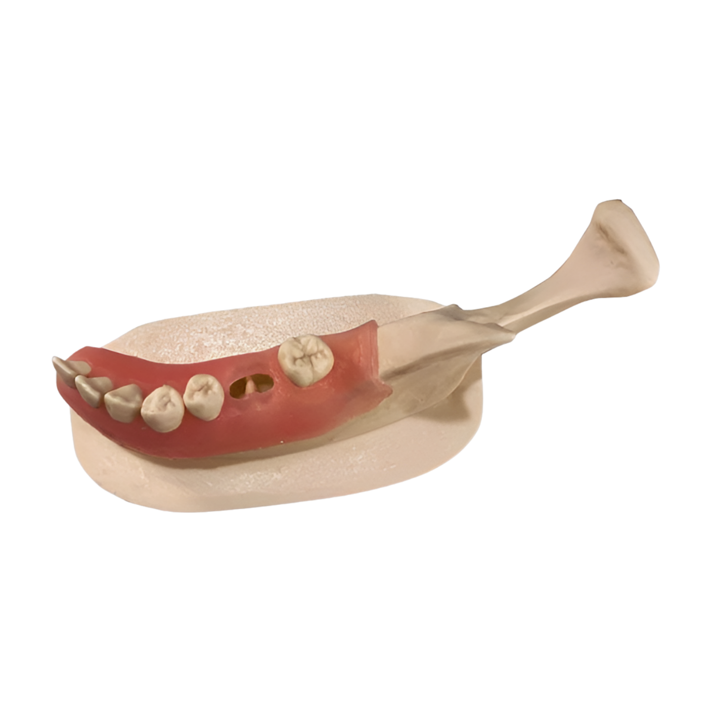 RIE-2 – Socket Grafting - Kilgore / Nissin RIE-2