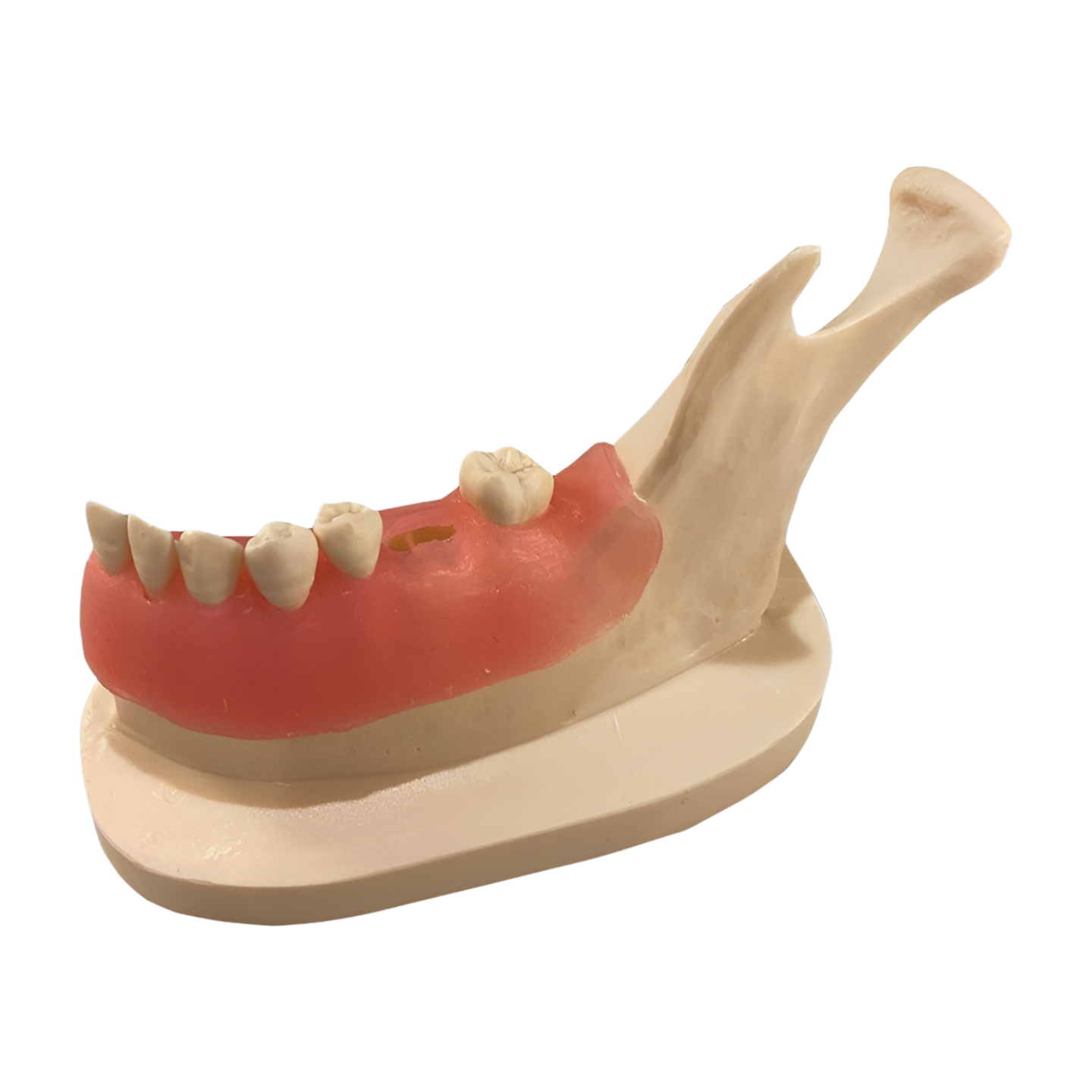 RIE-2 – Socket Grafting - Kilgore / Nissin RIE-2, view 2