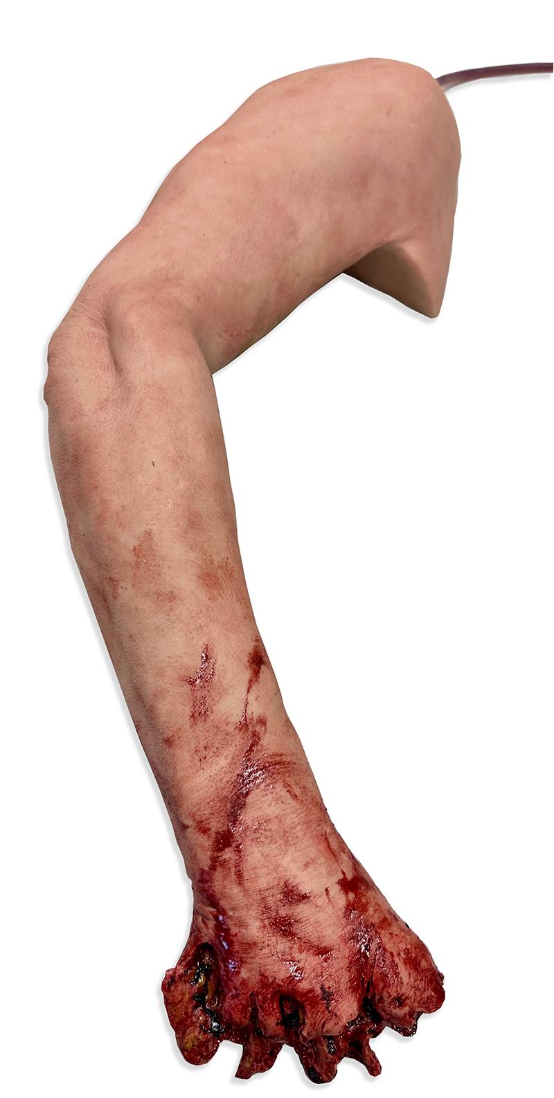 Tourniquet Trainer - Bleeding arm | Erler-Zimmer SE300