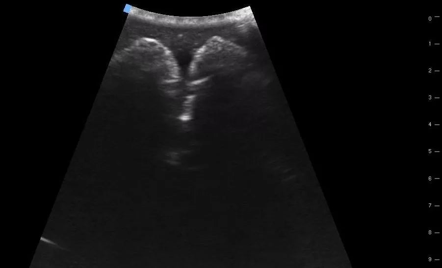 SonoEZ ultrasound trainer ‘Urinary bladder’ - Erler-Zimmer SEZ-BL, view 6
