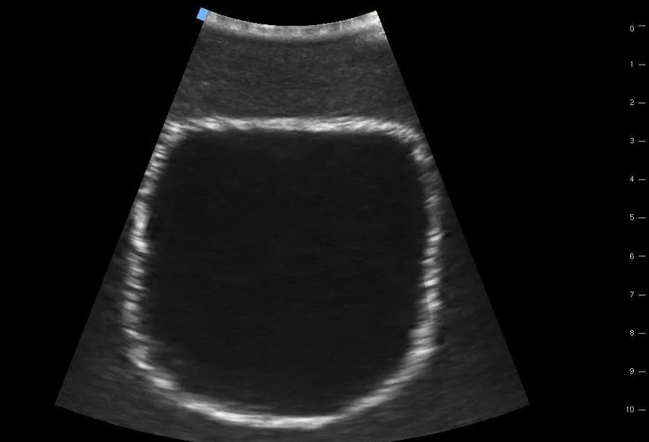 SonoEZ ultrasound trainer ‘Urinary bladder’ - Erler-Zimmer SEZ-BL, view 7
