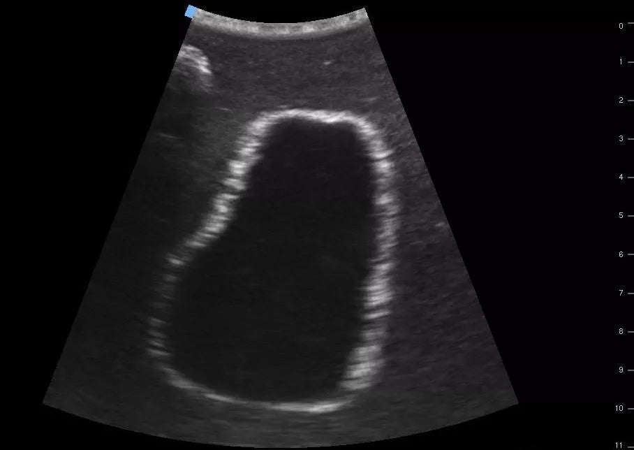 SonoEZ ultrasound trainer ‘Urinary bladder’ - Erler-Zimmer SEZ-BL, view 8