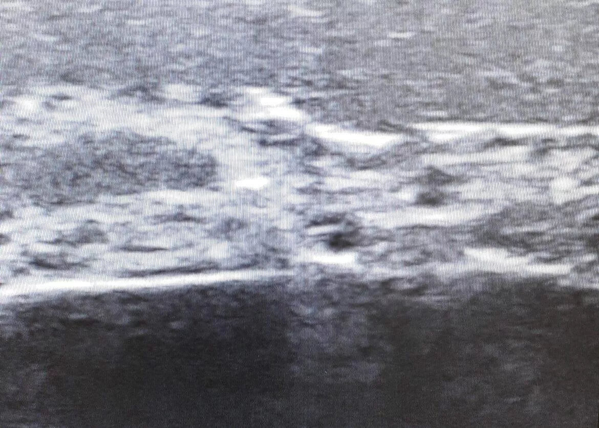 Ultrasound Face