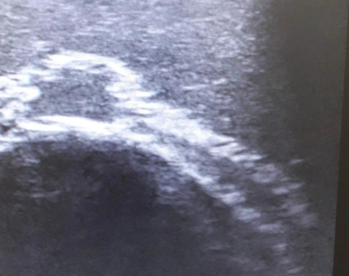 Ultrasound Face