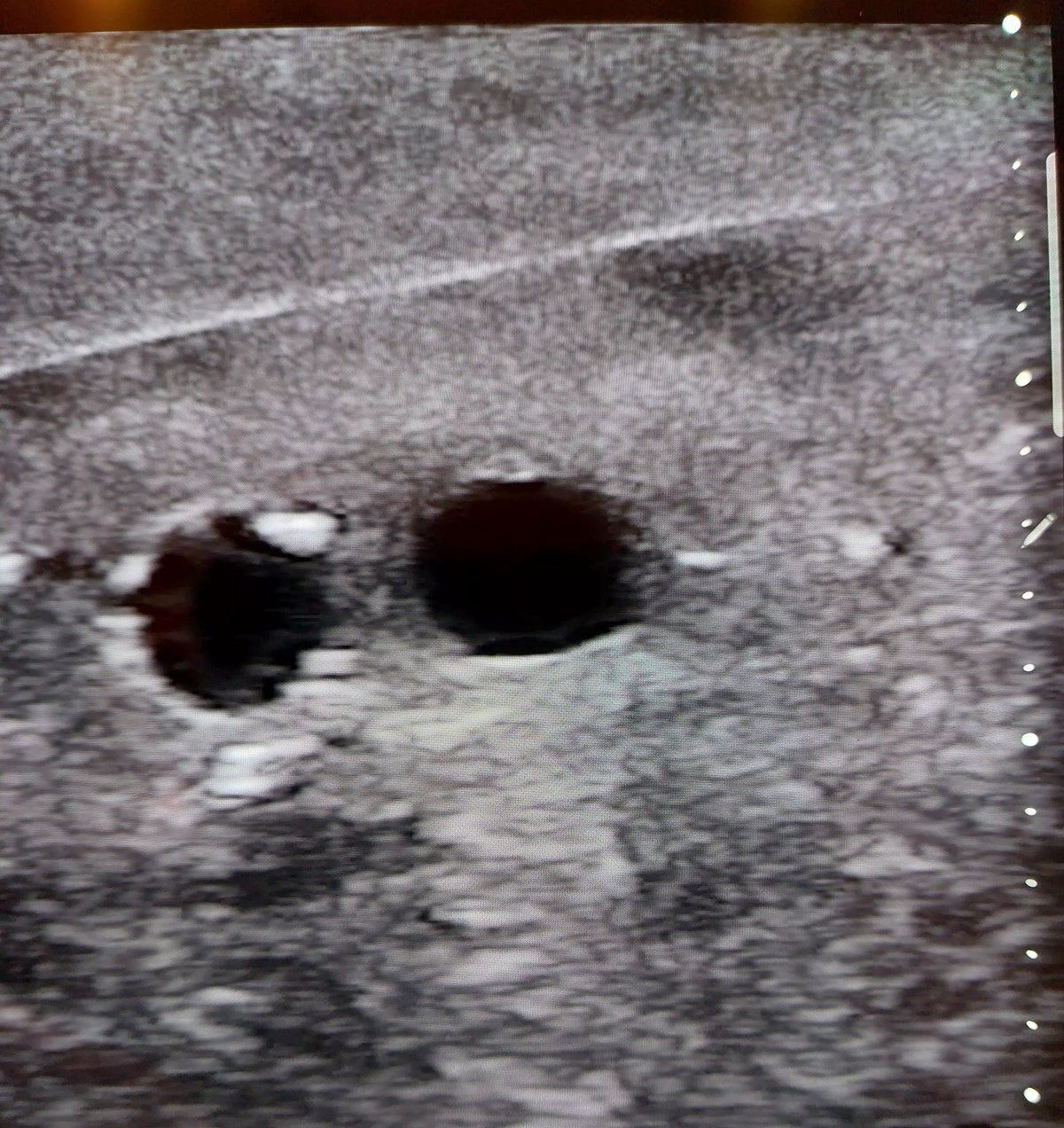 SonoEZ Paediatric Ultrasound Trainer ‘Femur’ - Erler-Zimmer SEZ-PD-FE, view 5