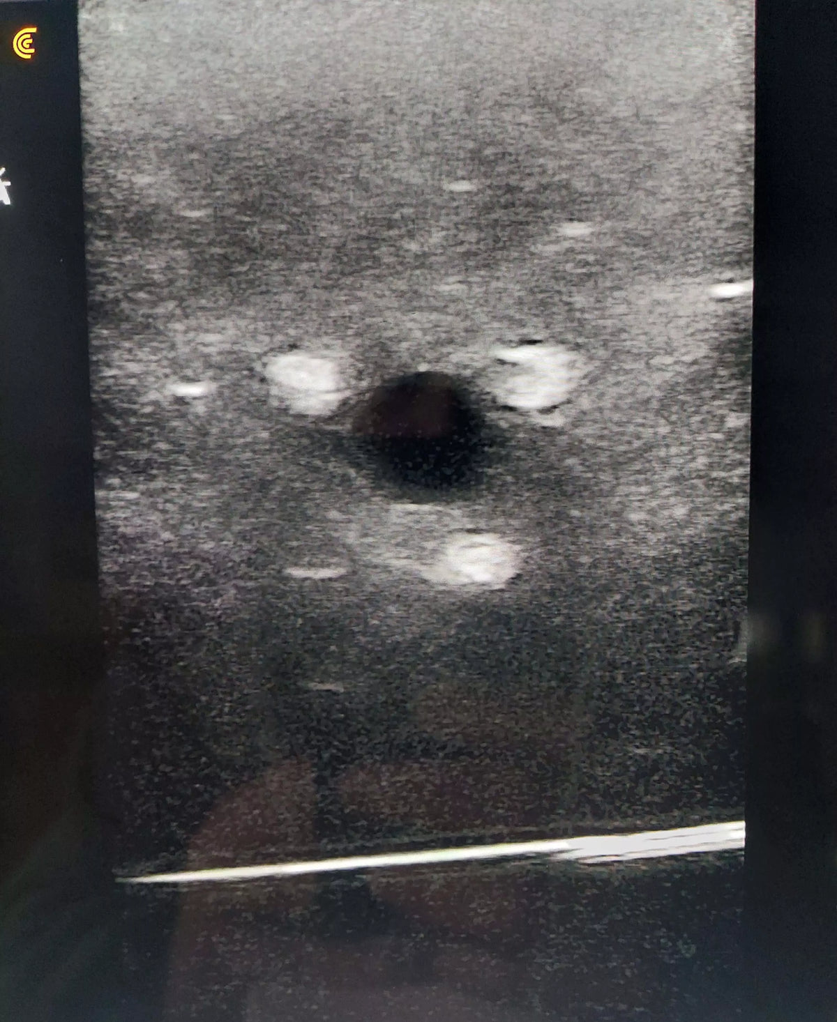 Ultrasound - Regional anaesthesia - Simulator - Erler-Zimmer SEZ-RA, view 4