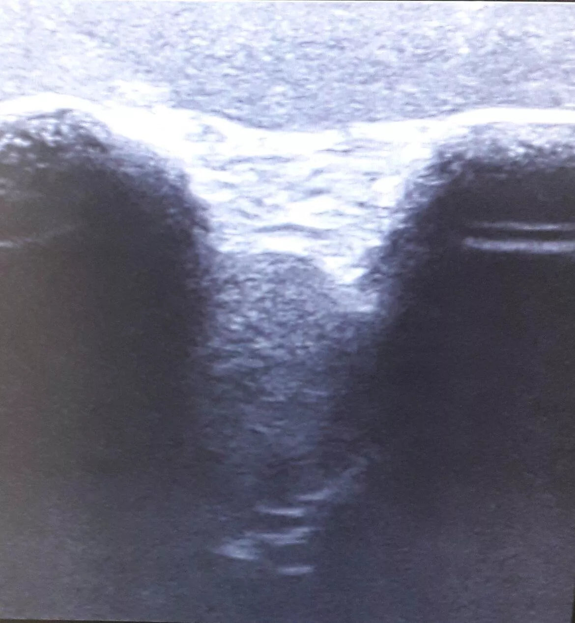 Ultrasound - Shoulder exercise model - Erler-Zimmer SEZ-SH, view 7