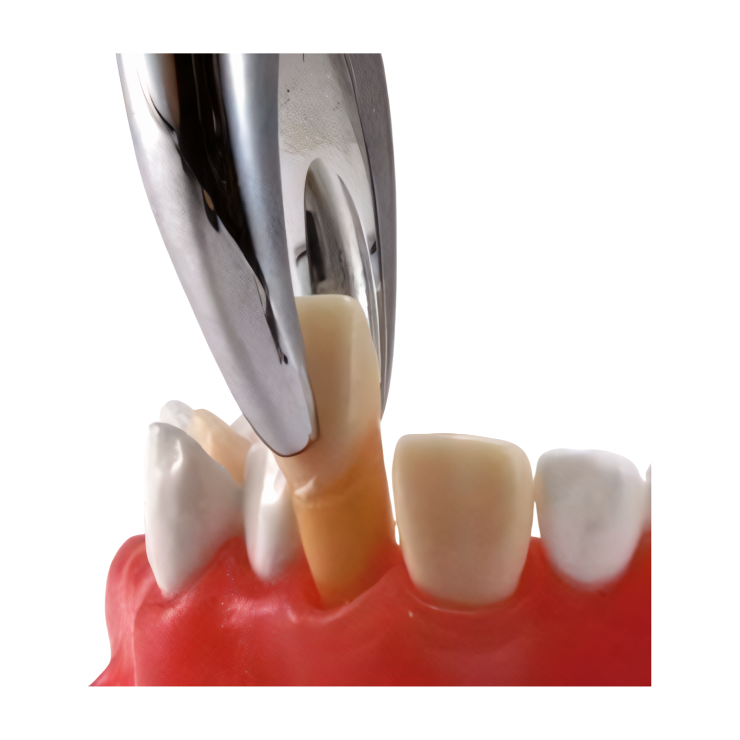SUG2004 – Tooth Extraction - Kilgore / Nissin SUG2004, view 3
