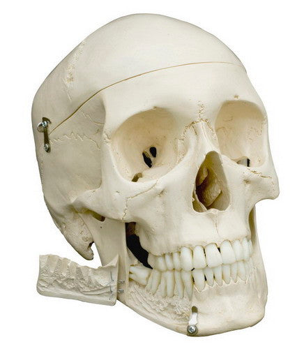 Skull with teeth for extraction, 4-part