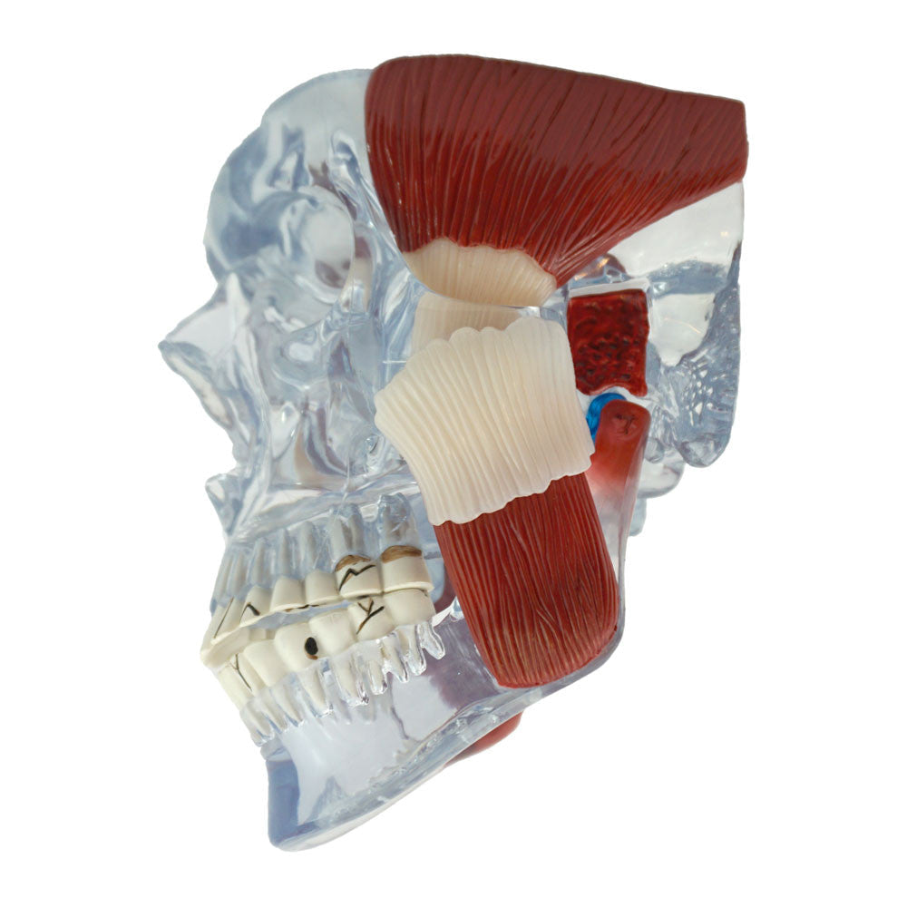 TMJ Model - joint issue