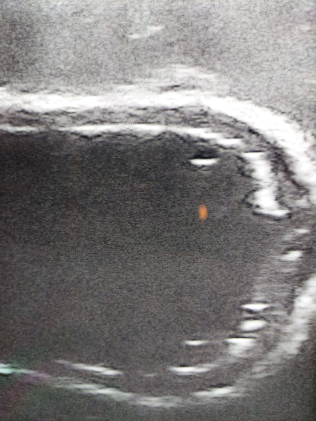 Canine Bladder Ultrasound simulator