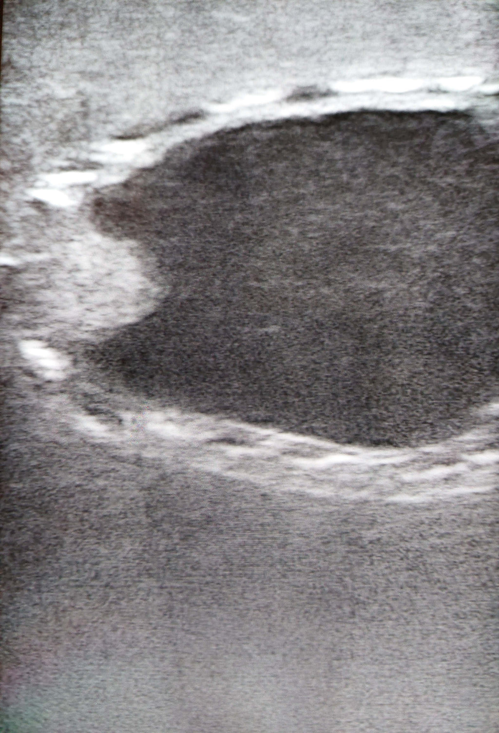 Canine Bladder Ultrasound simulator
