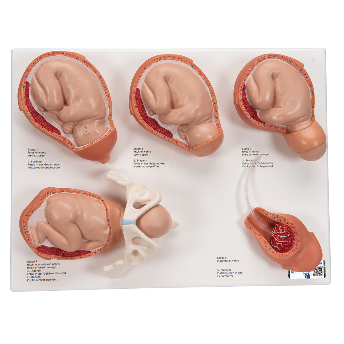 Labor Stages Model, Small
