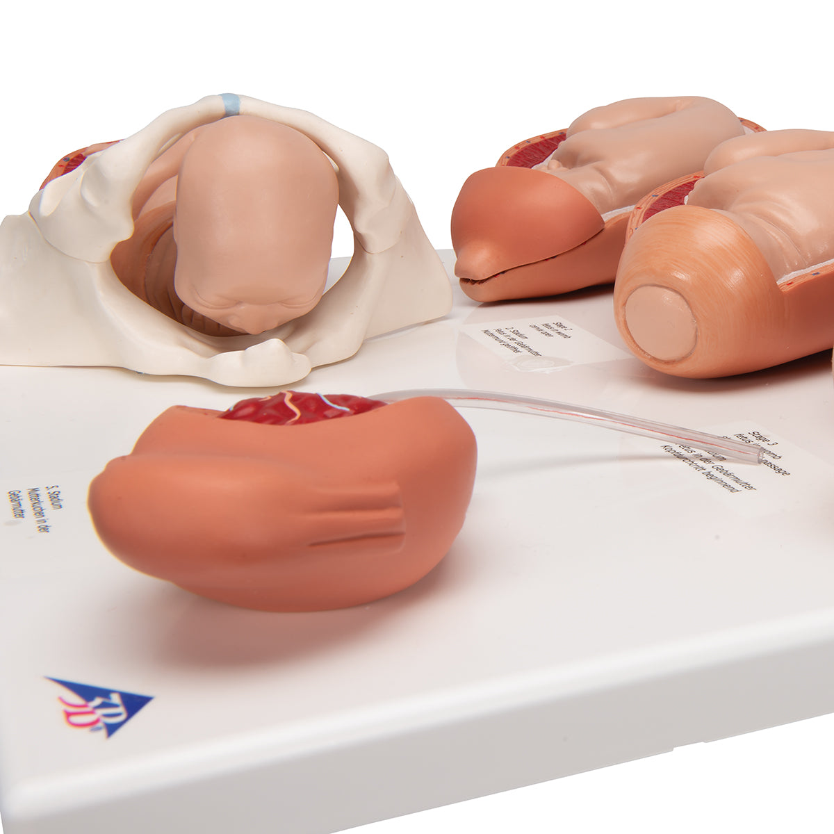 Labor Stages Model, Small