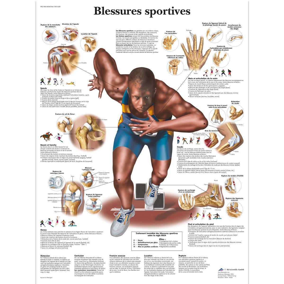 Blessures Sportives chart