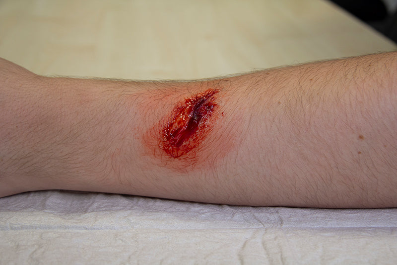 EZ wounds - Casualty simulation set for standardized patients | Erler-Zimmer WS03