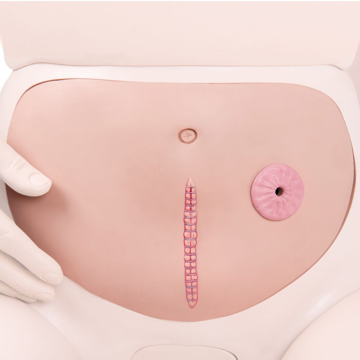 Abdominal Wall with Staple Suture
