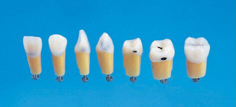 Composite Resin Teeth with Caries