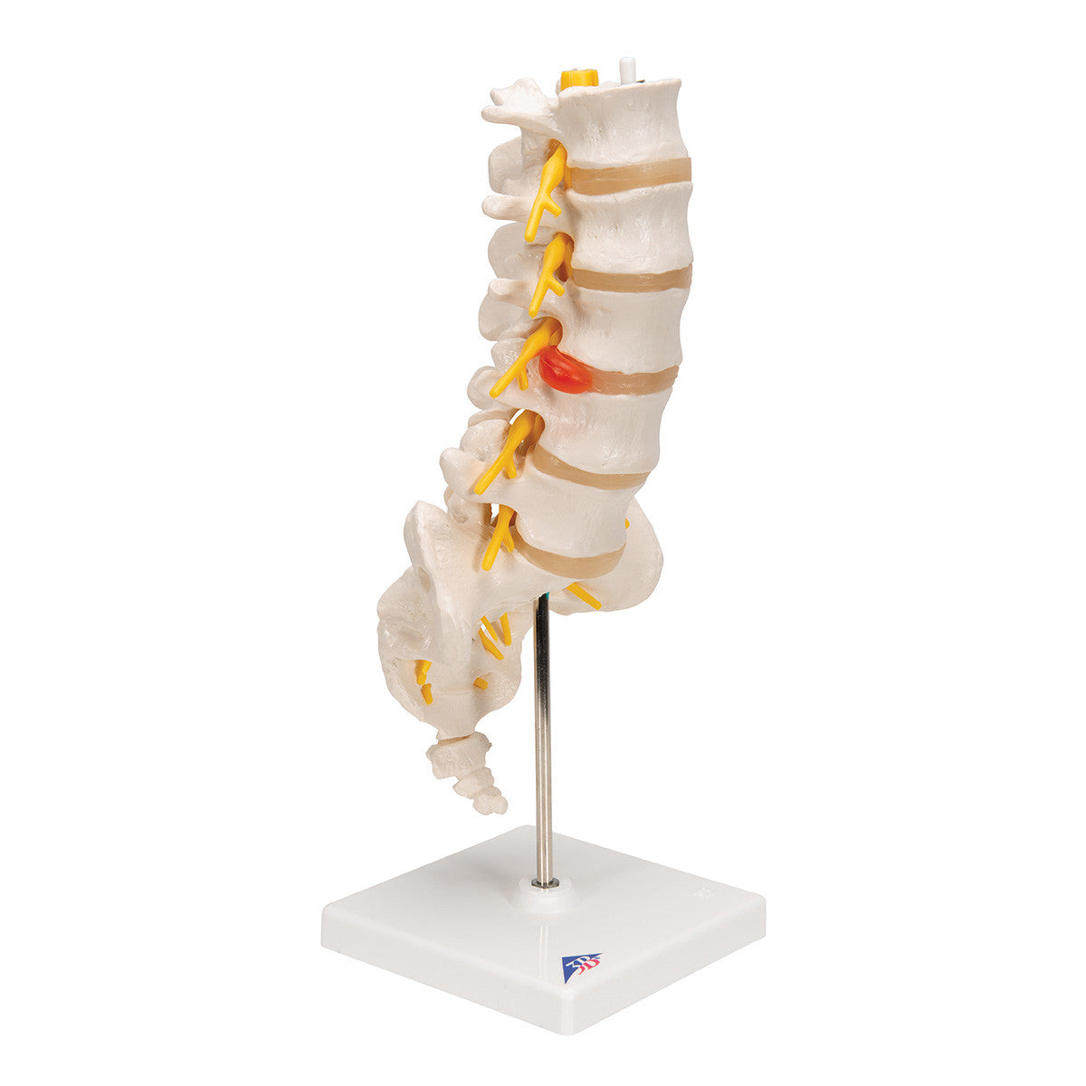 The lumbar model includes a dorso-lateral prolapsed inter-vertebral disc | 3B Scientific A76/5