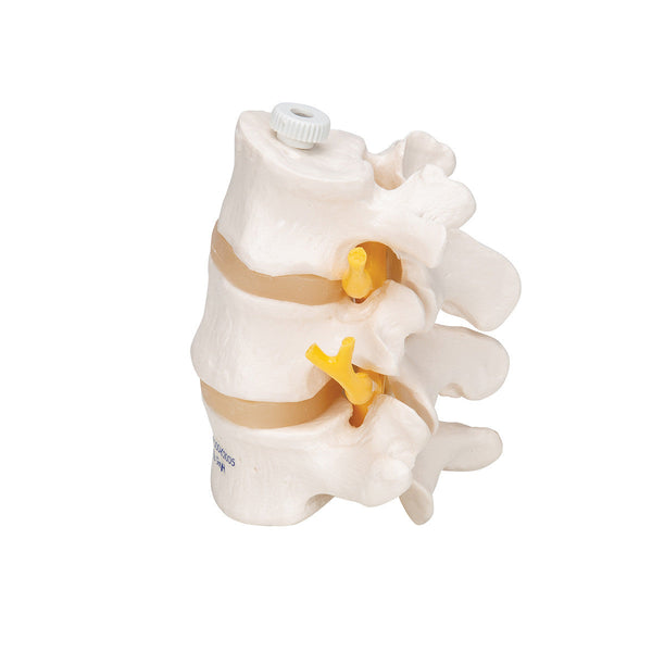3B Anatomical Model - 3 Human Lumbar Vertebrae, Flexibly Mounted 3B Anatomical Model - 3 Human Lumbar Vertebrae, Flexibly Mounted
