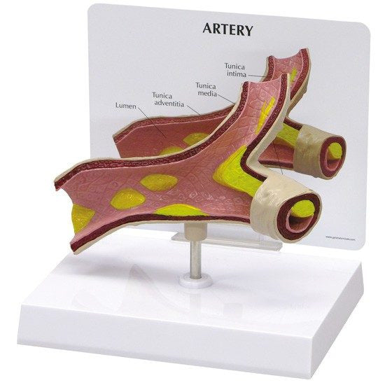 artery-model-1-550x550__55771.1643511676.1280.1280.jpg