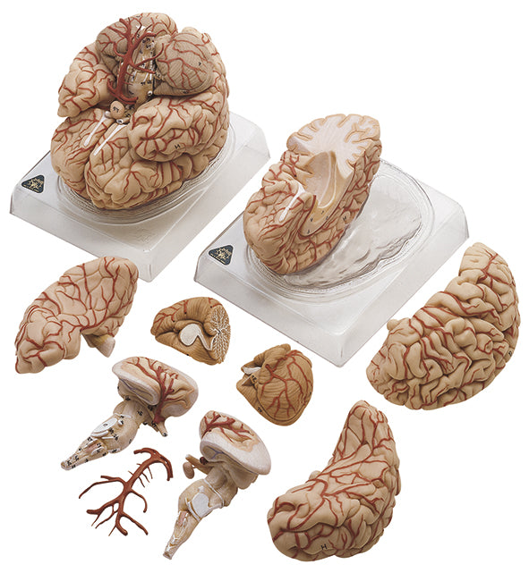 Brain with Arteries BS 23 — Somso | Candent Canada