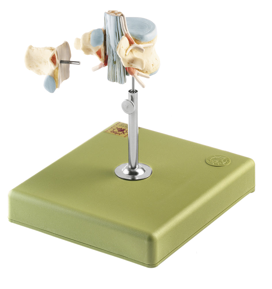 Lumbar Vertebra (L II) with Lumbar Region of Spinal Cord
