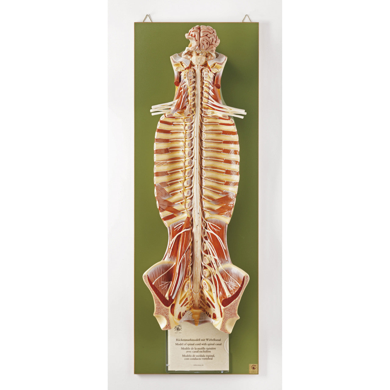 Spinal Cord in the Spinal Canal Somso Bs 31