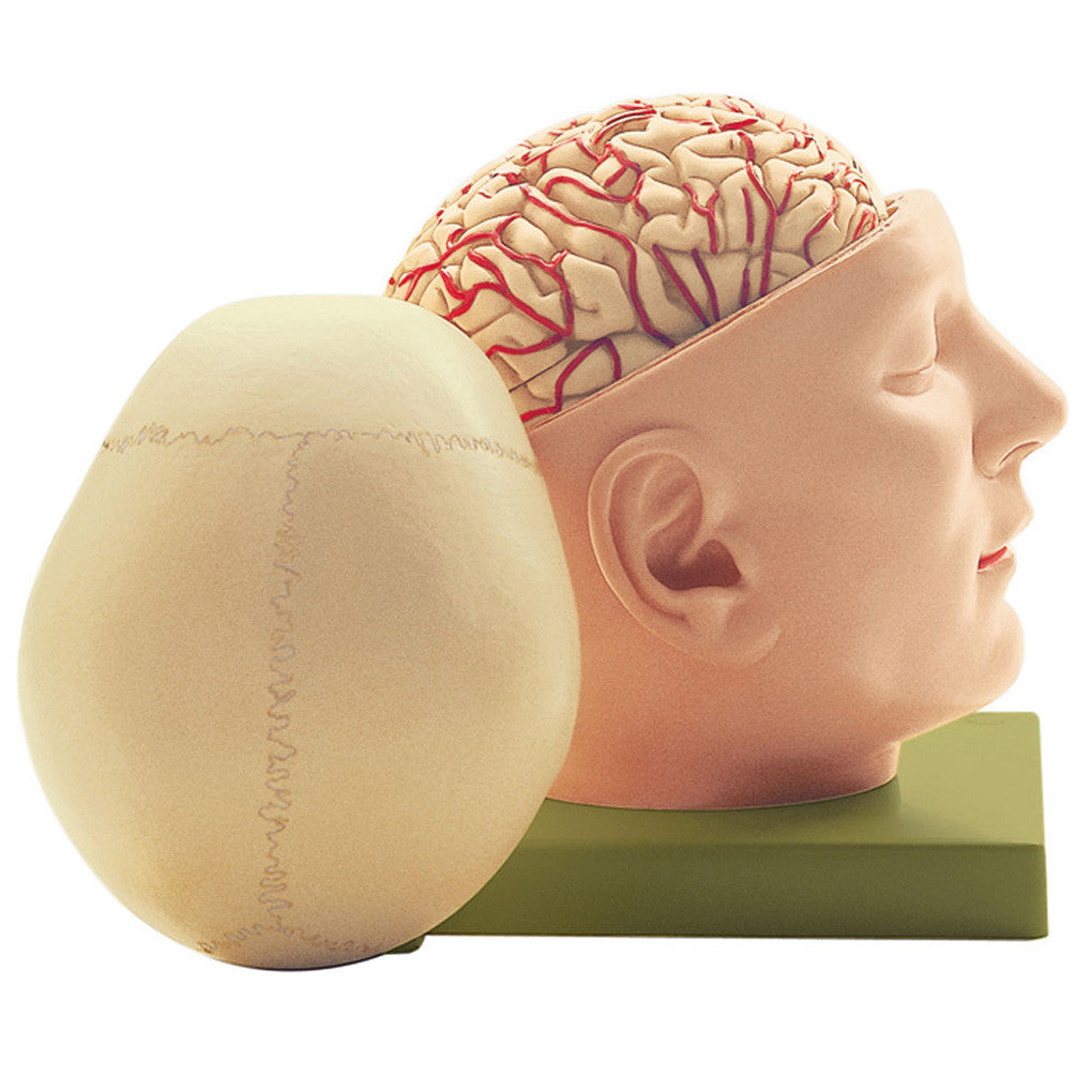 Brain with Base of the Head and Cranial Cap | Somso Bs 5/2