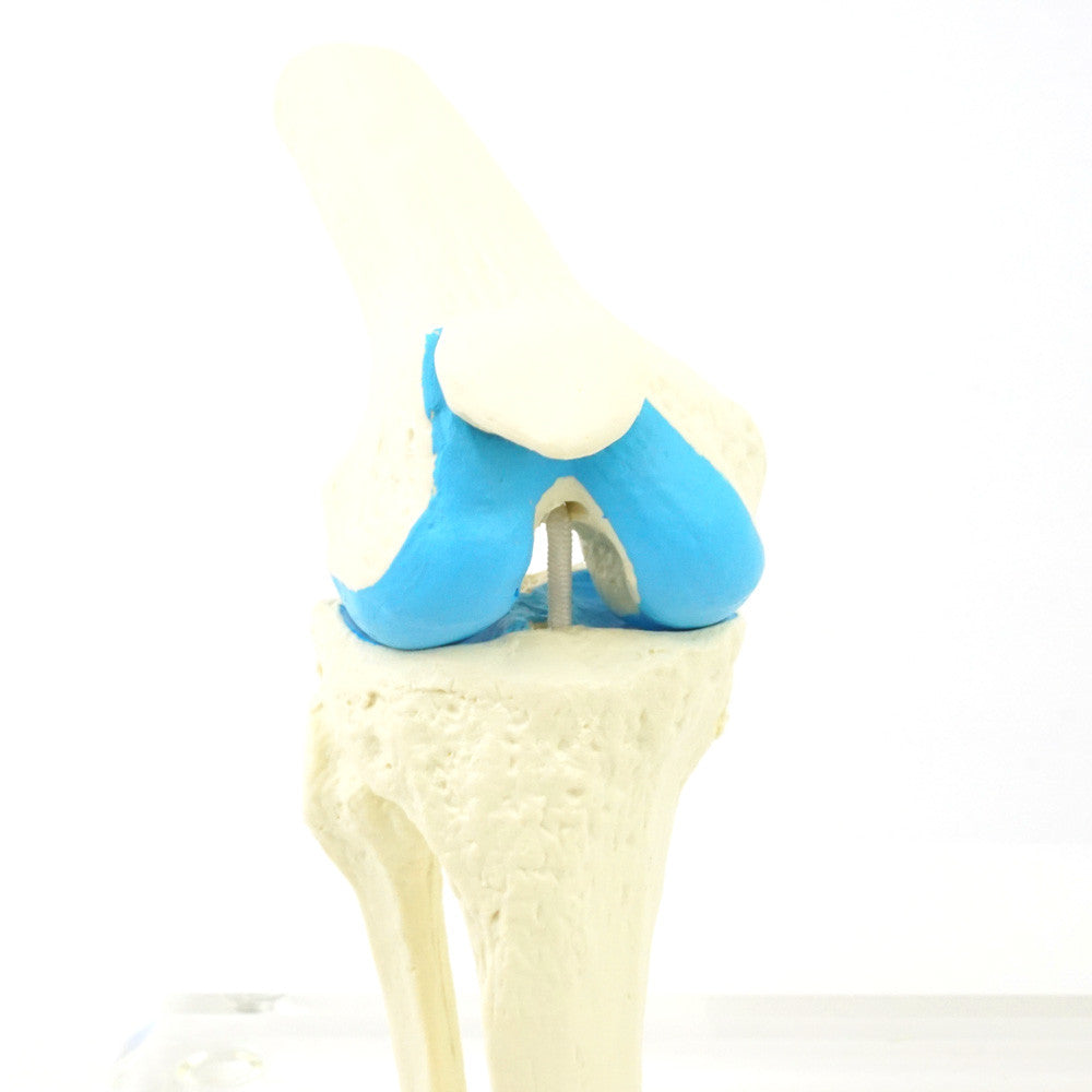 candent_1125_knee_replacement_set_02__53971.1650291642.1280.1280.jpg