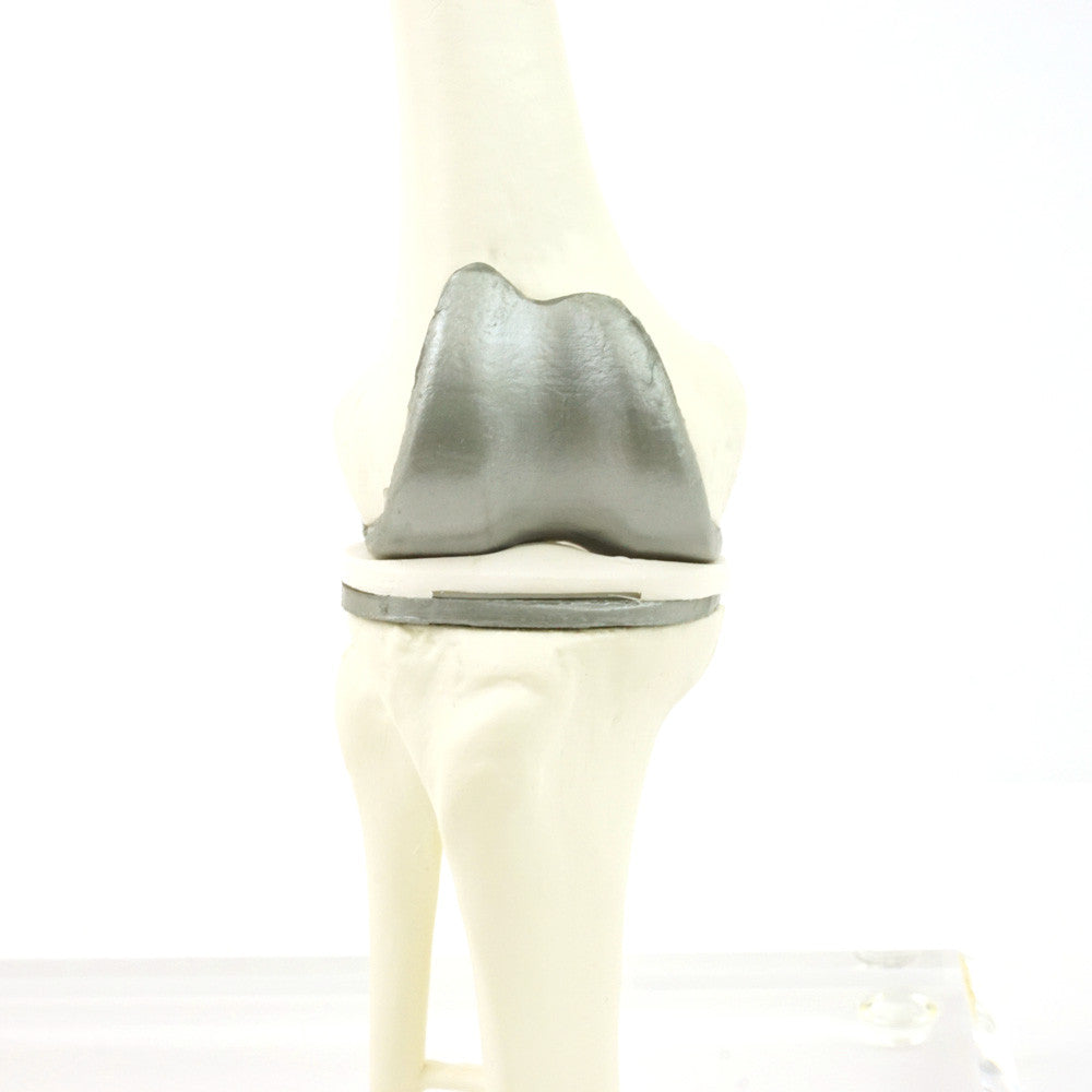 candent_1125_knee_replacement_set_06__98425.1650291642.1280.1280.jpg