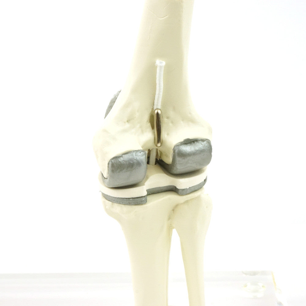 candent_1125_knee_replacement_set_07__75488.1650291642.1280.1280.jpg