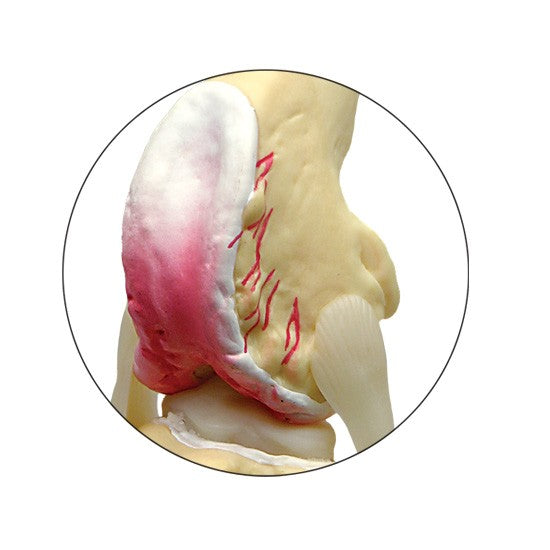4-Stage Osteoarthritis (OA) Canine Knee Set
