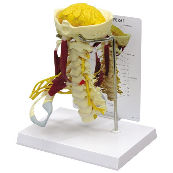 Muscled Cervical Vertebrae
