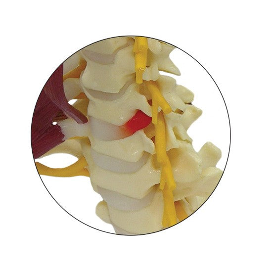 Muscled Cervical Vertebrae