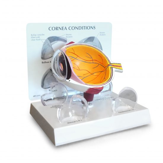 Cornea Eye (cut-away)