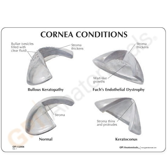 Cornea Eye (cut-away)