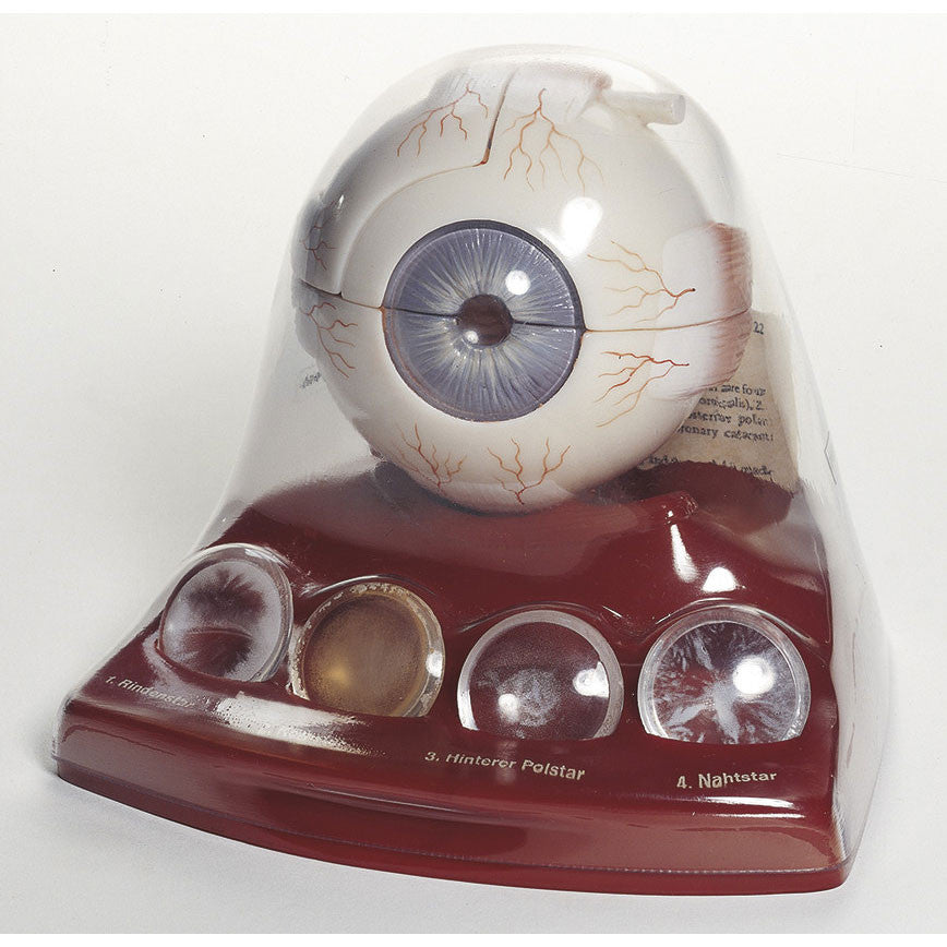 Cataract Eye Model 1 | Somso Cs 22