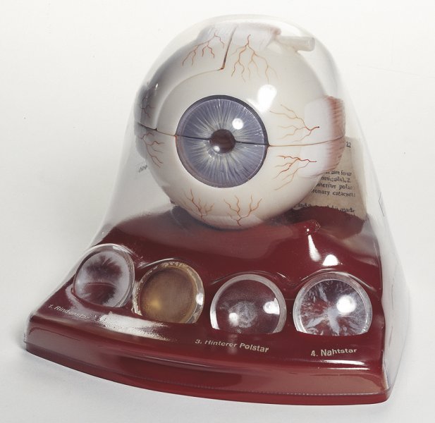 Cataract Eye Model (CS 22) - Somso