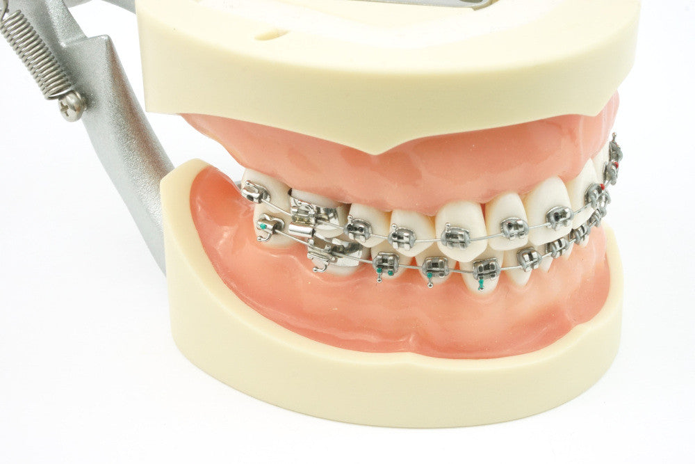 1 piece Dental Oral Care Tooth Teeth Model Dental Orthodontic Model for Patient Communication Dentist Study Model Buy cheaply on 1 piece Dental Oral Care Tooth Teeth Model Dental Orthodontic Model for Patient Communication Dentist Study Model Buy cheaply on