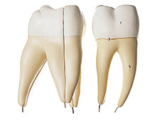 Lower Molar with Two Roots
