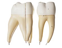 Lower Molar with Two Roots